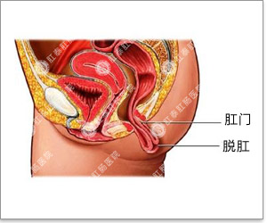 福州肛肠医院 福州医博肛肠医院 福州看痔疮的医院 福州肛瘘医院 福州肛裂医院 福州肠炎医院