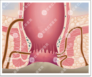 福州肛肠医院 福州医博肛肠医院 福州看痔疮的医院 福州肛瘘医院 福州肛裂医院 福州肠炎医院