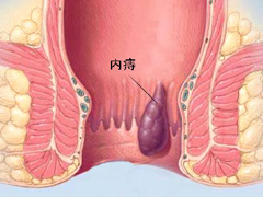 福州肛肠医院