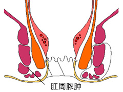 福州肛肠医院 福州医博肛肠医院 福州看痔疮的医院 福州肛瘘医院 福州肛裂医院 福州肠炎医院