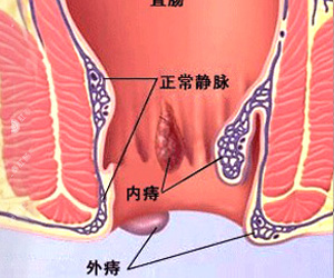 福州肛肠医院