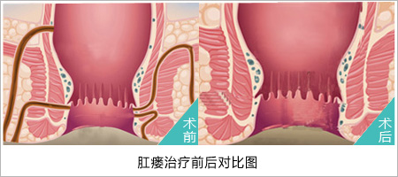 福州肛肠医院